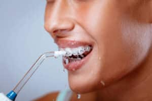 واترجت دندان چیست ؟ مزایا،انواع و دلایل استفاده